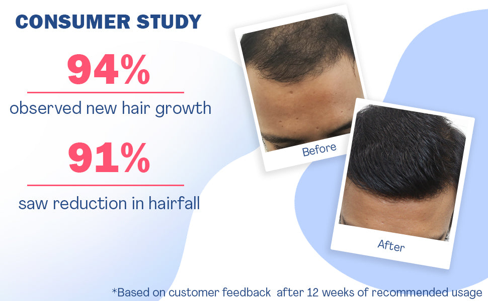 WishCare Hair Growth Serum Concentrate - Redensyl & Anagain, 30ml - 2