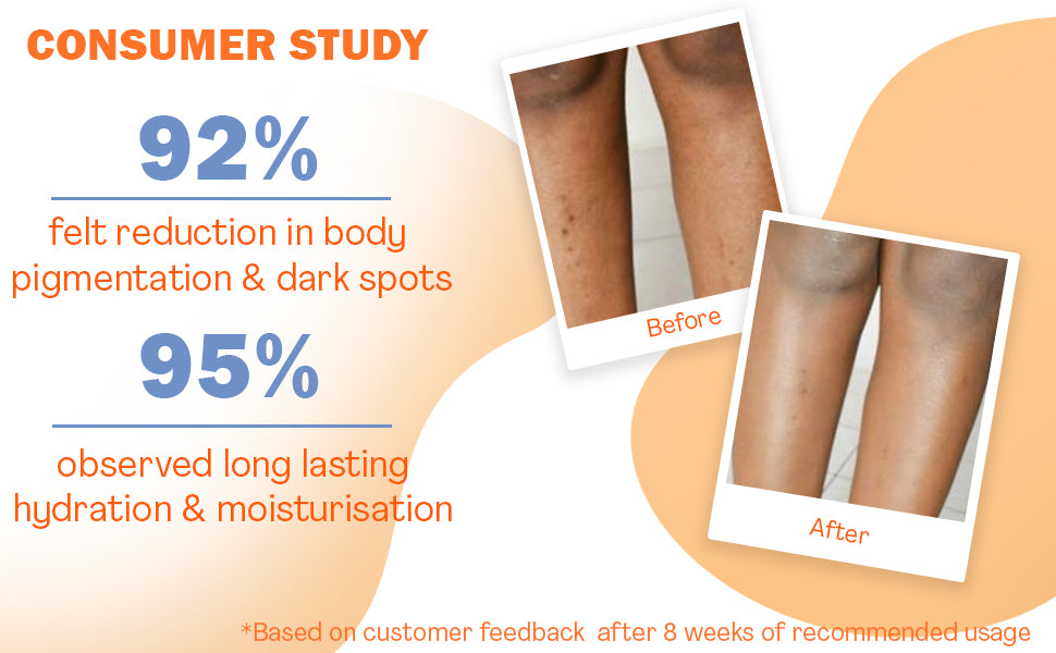 WishCare Multi-Vitamin Brightening Body Lotion - 5% Vitamin C & Niacinamide, 200ml - 2